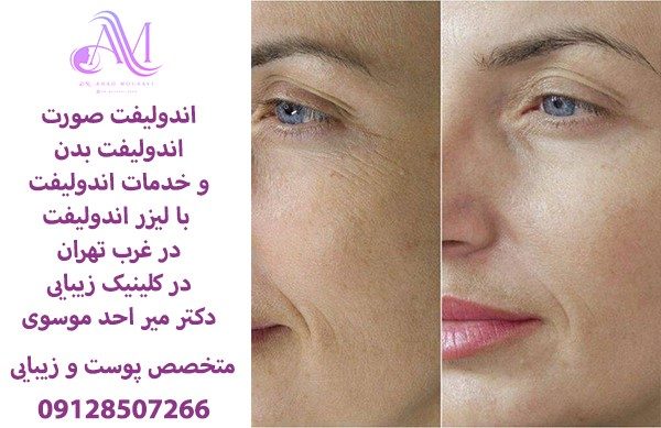 کلینیک زیبایی دکتر میر احد موسوی