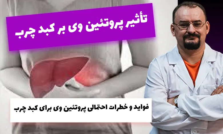 تاثیر پروتئین وی بر کبد چرب