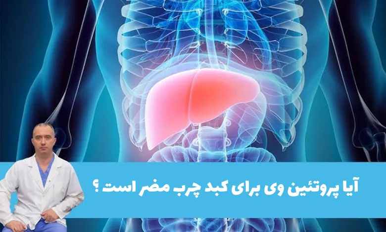 پروتئین وی و کبد چرب
