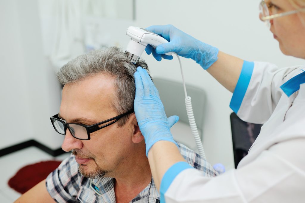 بهترین رو کاشت مو