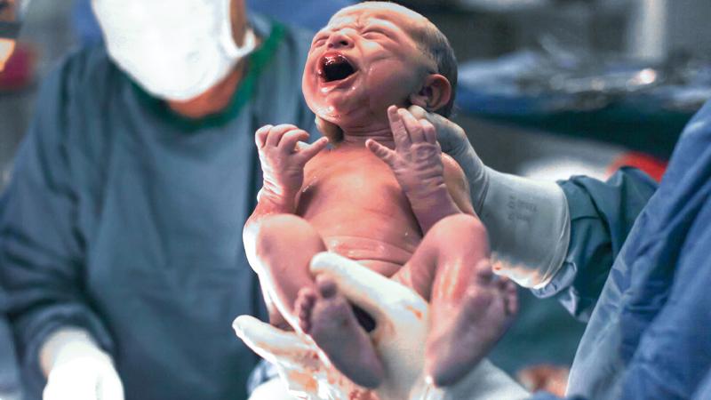 دکتر زایمان طبیعی