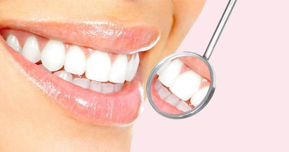 لمینت دندان، کلید لبخندی جذاب‌تر و ماندگارتر