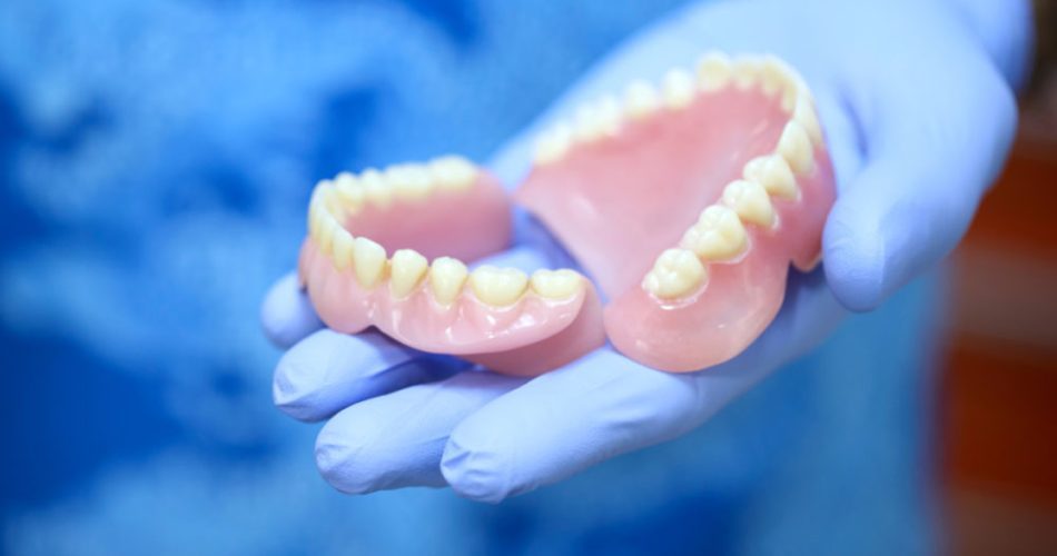 قالب گیری دندان مصنوعی