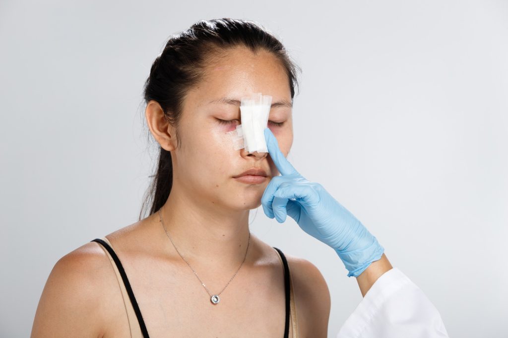 عمل بینی با جدیدترین روش