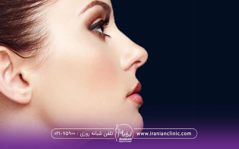 نیمرخ فردی که به یک سمت نگاه میکند و اندولیفت صورت انجام داده است