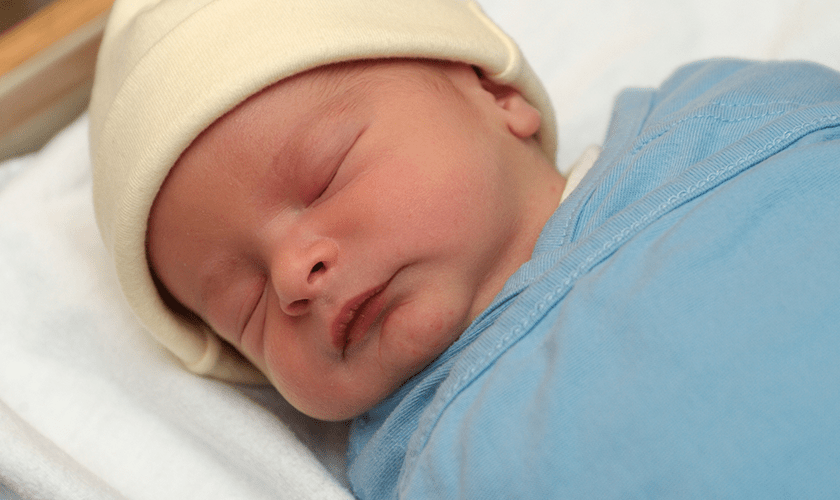 زردی نوزادان