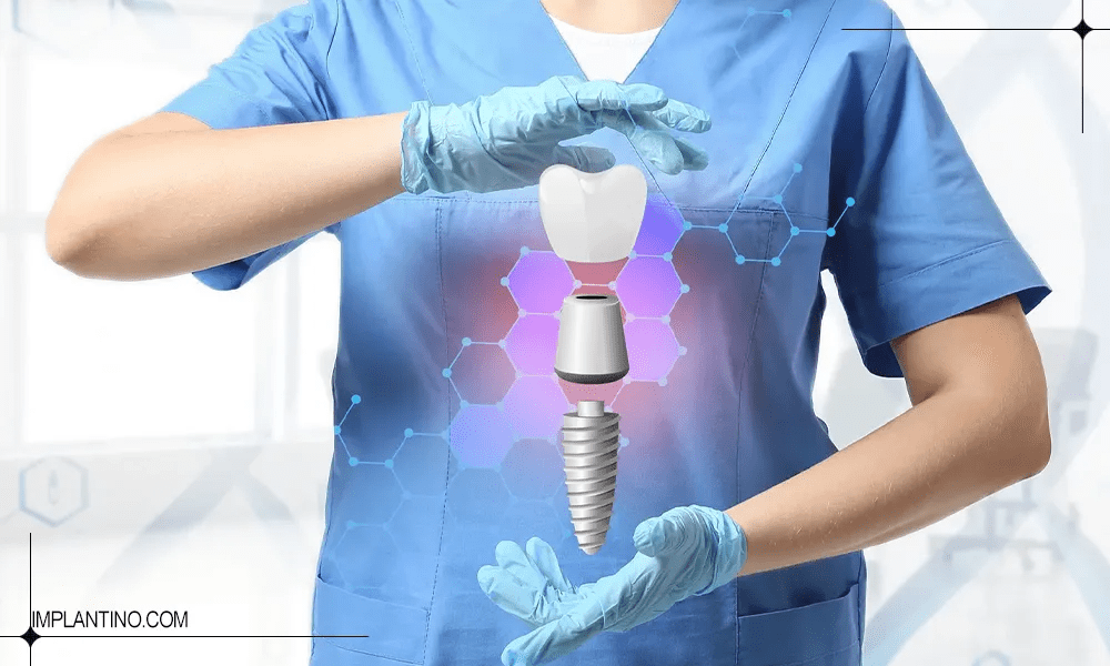 نمایش دیجیتال ایمپلنت دندان و دکتر ایمپلنت دندان