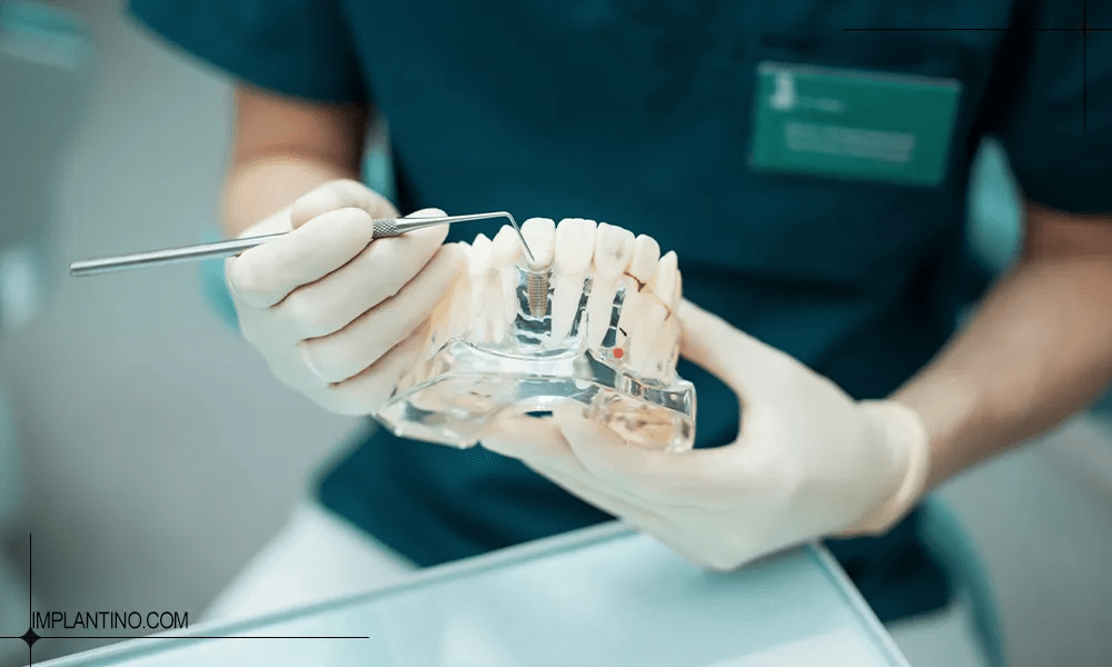 دکتر ایمپلنت در تهران در حال نشان دادن ماکت دندان ها که ایمپلنت در آن قرار گرفته است.