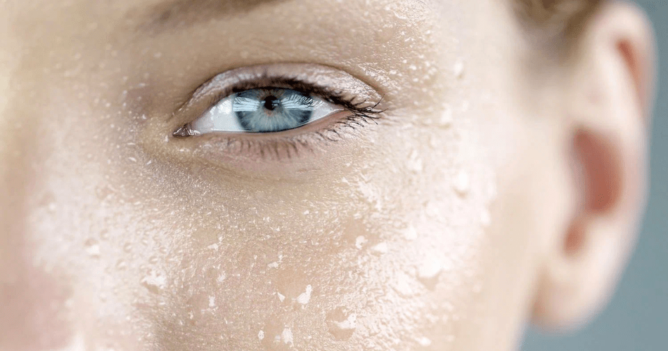 مراقبت از پوست در گرما