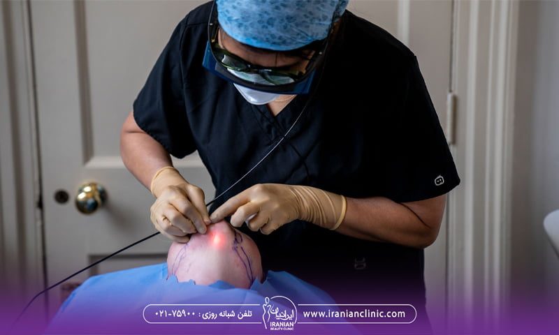 پزشکی که بالای سر فرد ایستاده و زیر چانه او را اندولیفت می کند