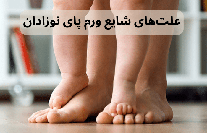 علت های شایع وروم روی پای نوزادان