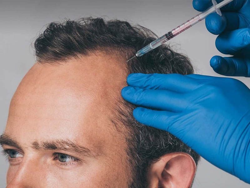 روش انجام سلول تراپی