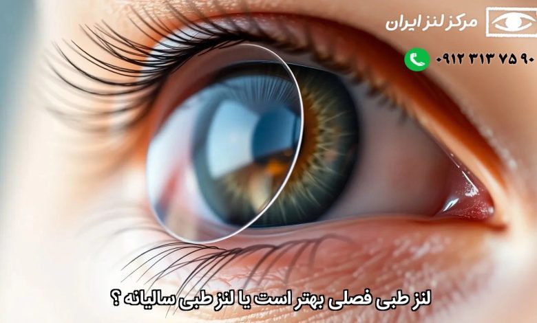 برندهای معتبر لنز طبی