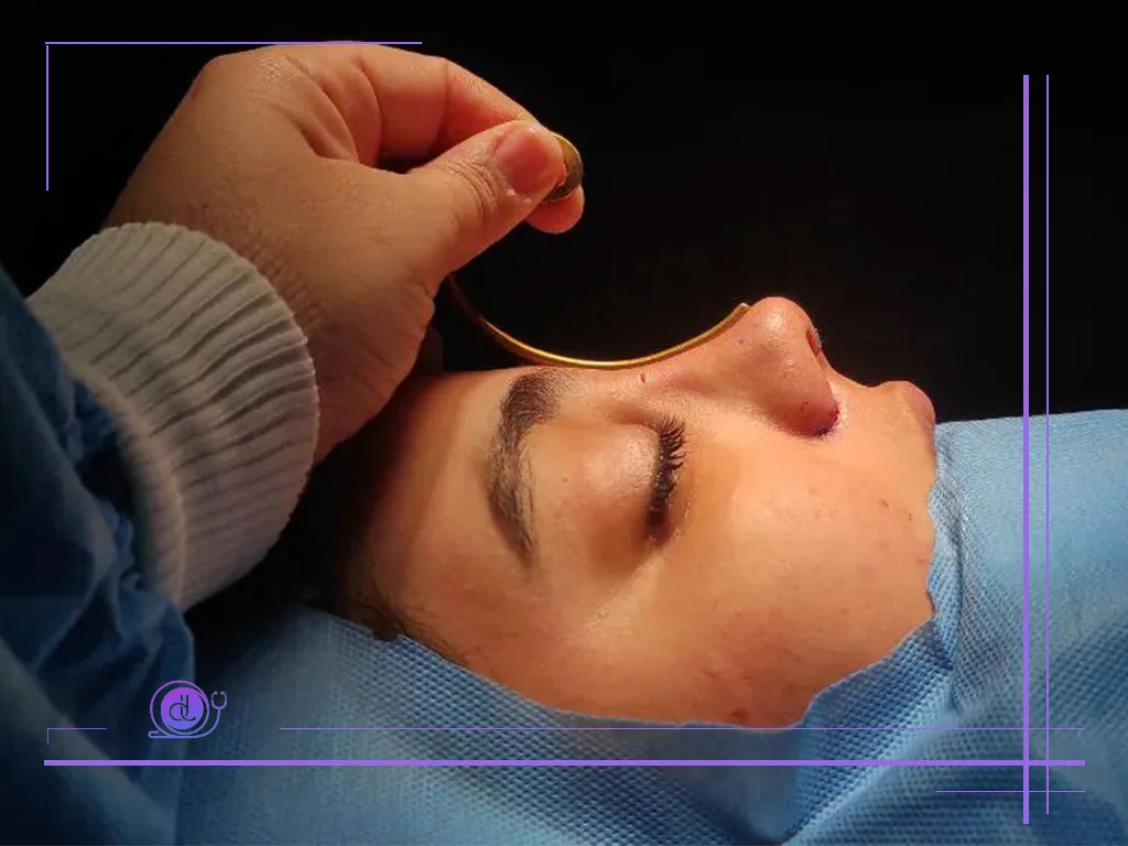 نمونه کار پرطرفدارترین جراح بینی در شیراز - دکتر عرفانی زاده