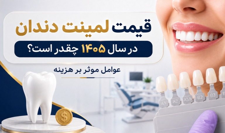 قیمت لمینت دندان در سال 1405 چقدر است؟ مقایسه قیمت انواع لمینت دندان