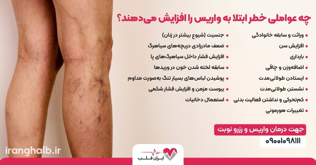 چه عواملی خطر ابتلا به واریس را افزایش می‌دهند؟