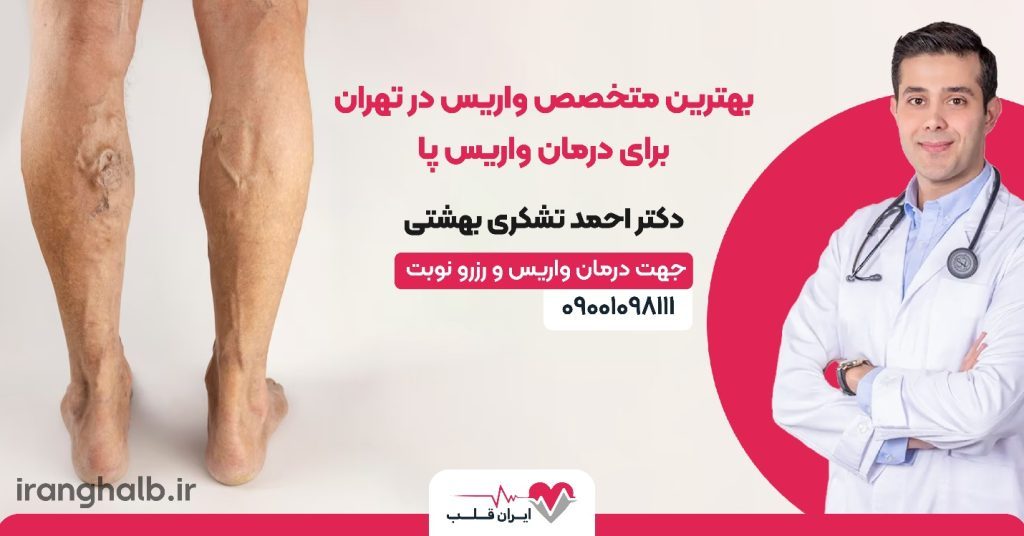 بهترین متخصص واریس در تهران برای درمان واریس پا
