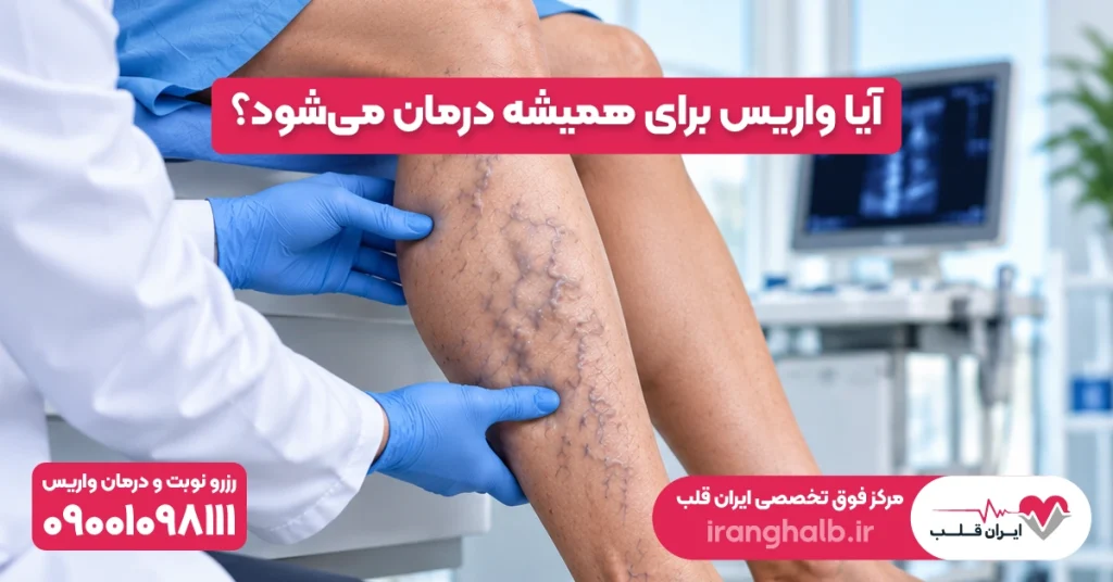 آیا واریس برای همیشه درمان میشود؟