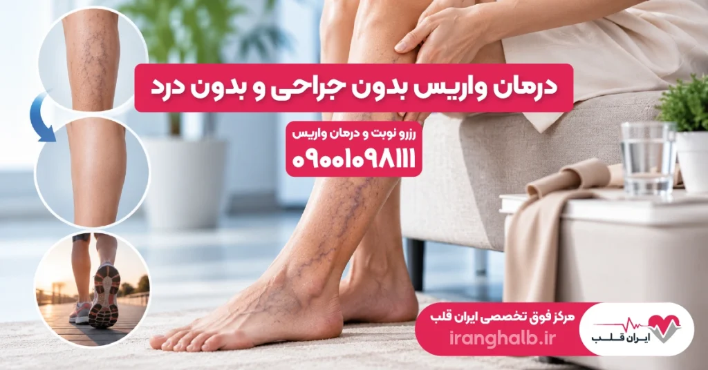 درمان واریس بدون جراحی و بدون درد