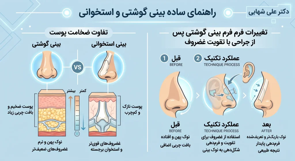 تغییرات فرم بینی گوشتی پس از جراحی با تکنیک تقویت غضروف