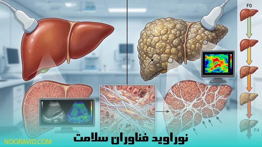 تفاوت کبد سالم و کبد مبتلا به فیبروز کبدی