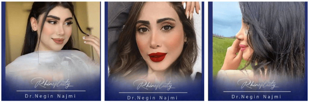بهترین جراح بینی در رشت