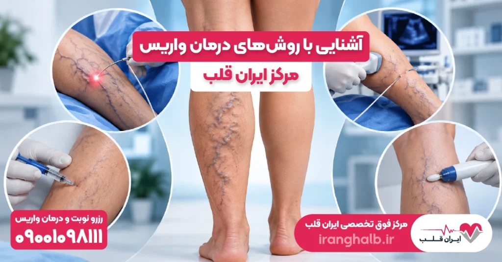 آشنایی با روشهای درمان واریس مرکز ایران قلب (بدون جراحی و بدون درد)