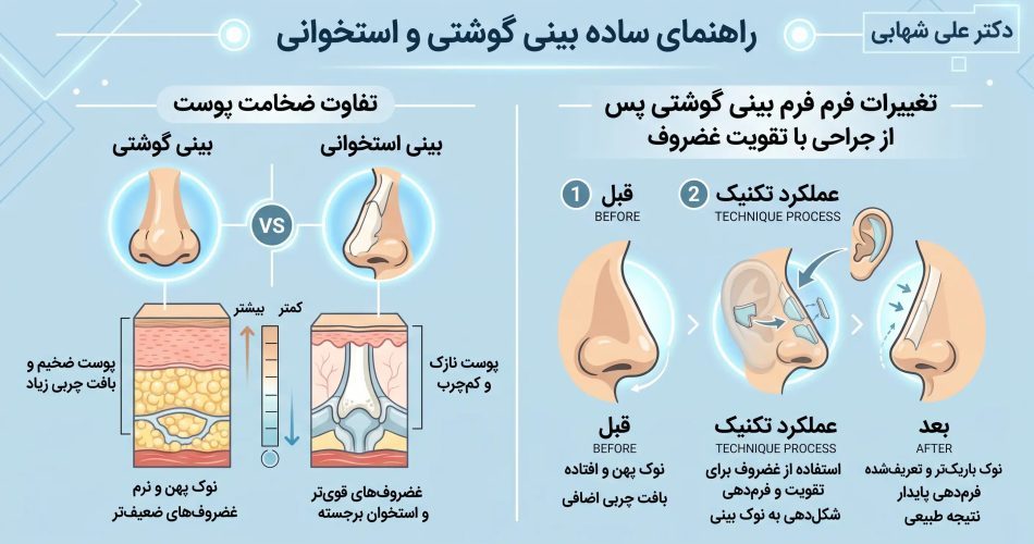 تغییرات فرم بینی گوشتی پس از جراحی با تکنیک تقویت غضروف